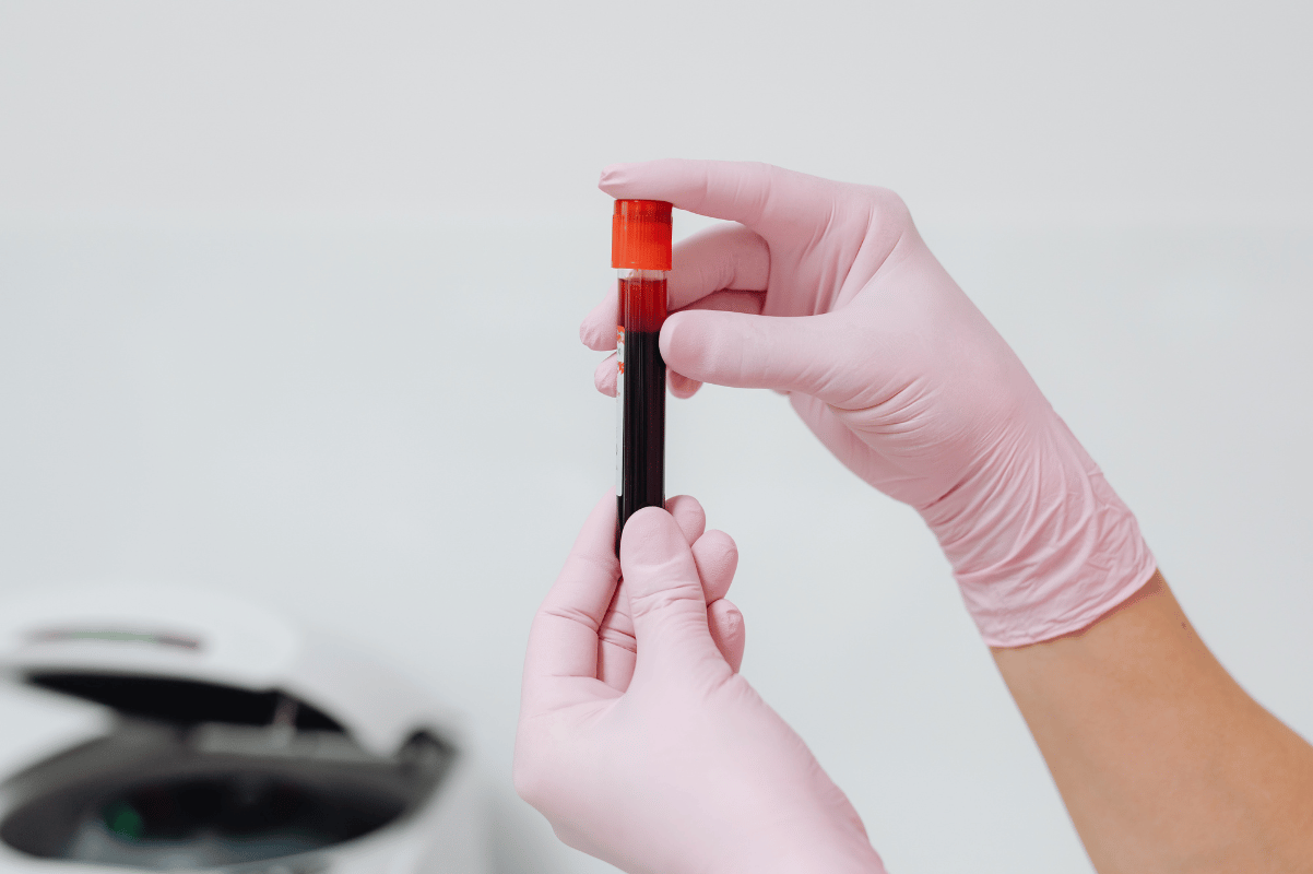 blood sample tube laboratory test